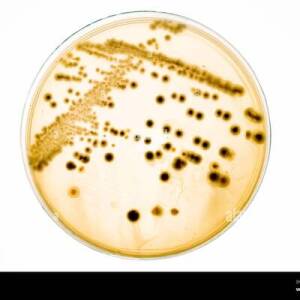 Collection of Cells